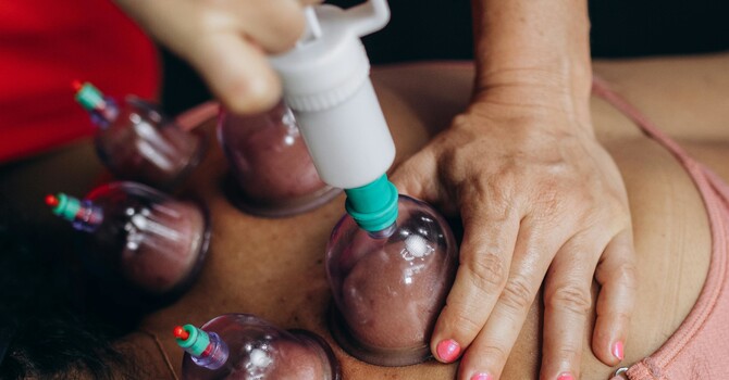 Cupping Therapy